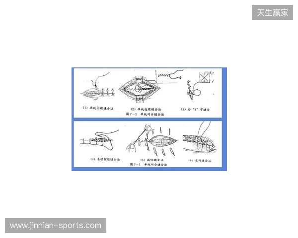 广州豹官方:杨浩眉弓伤口缝合30余针,预计5-7天后拆线
